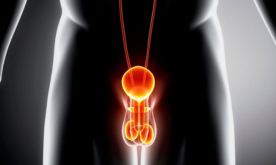 Système parental enflammé pour la prostatite